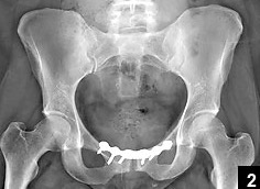 Voila_Capture 2015-11-14_04-05-47_PM